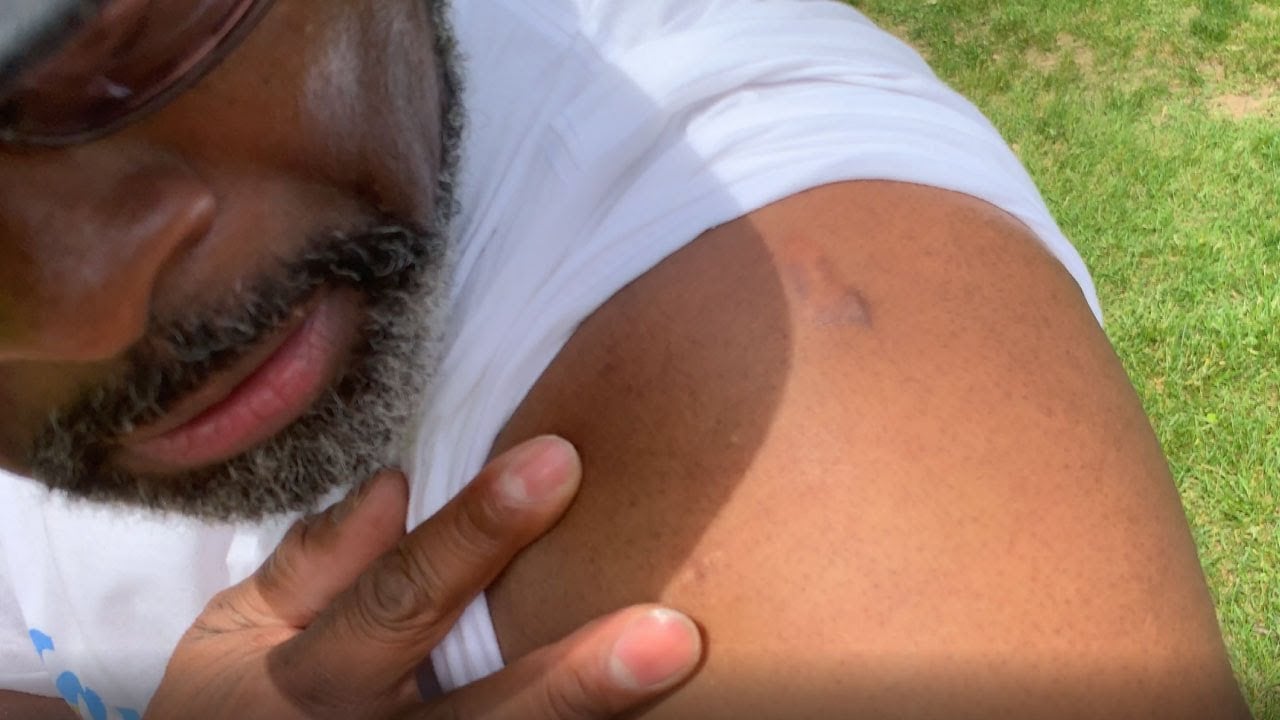 ╫ New Ligaments, New Shoulder, and No More Cane! - Testimony Story [PODCAST]