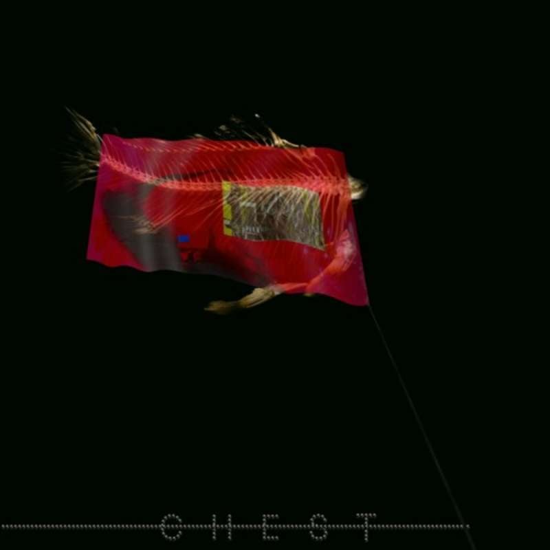 CHEST